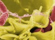 salmonella