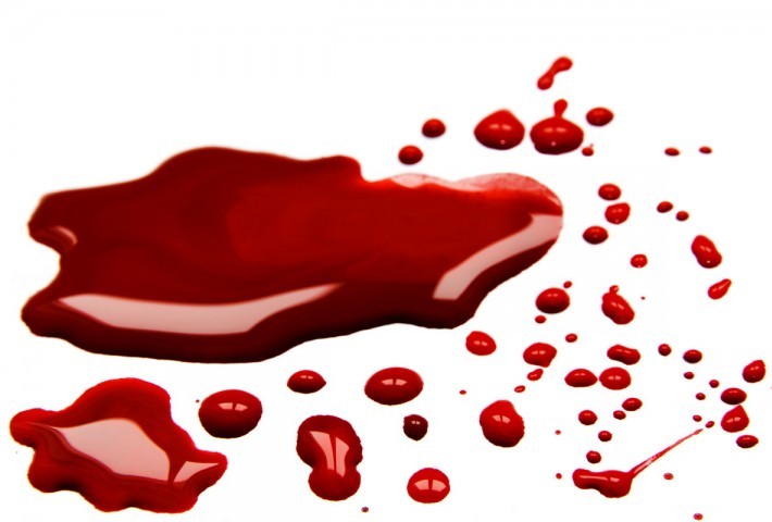 bleeding 